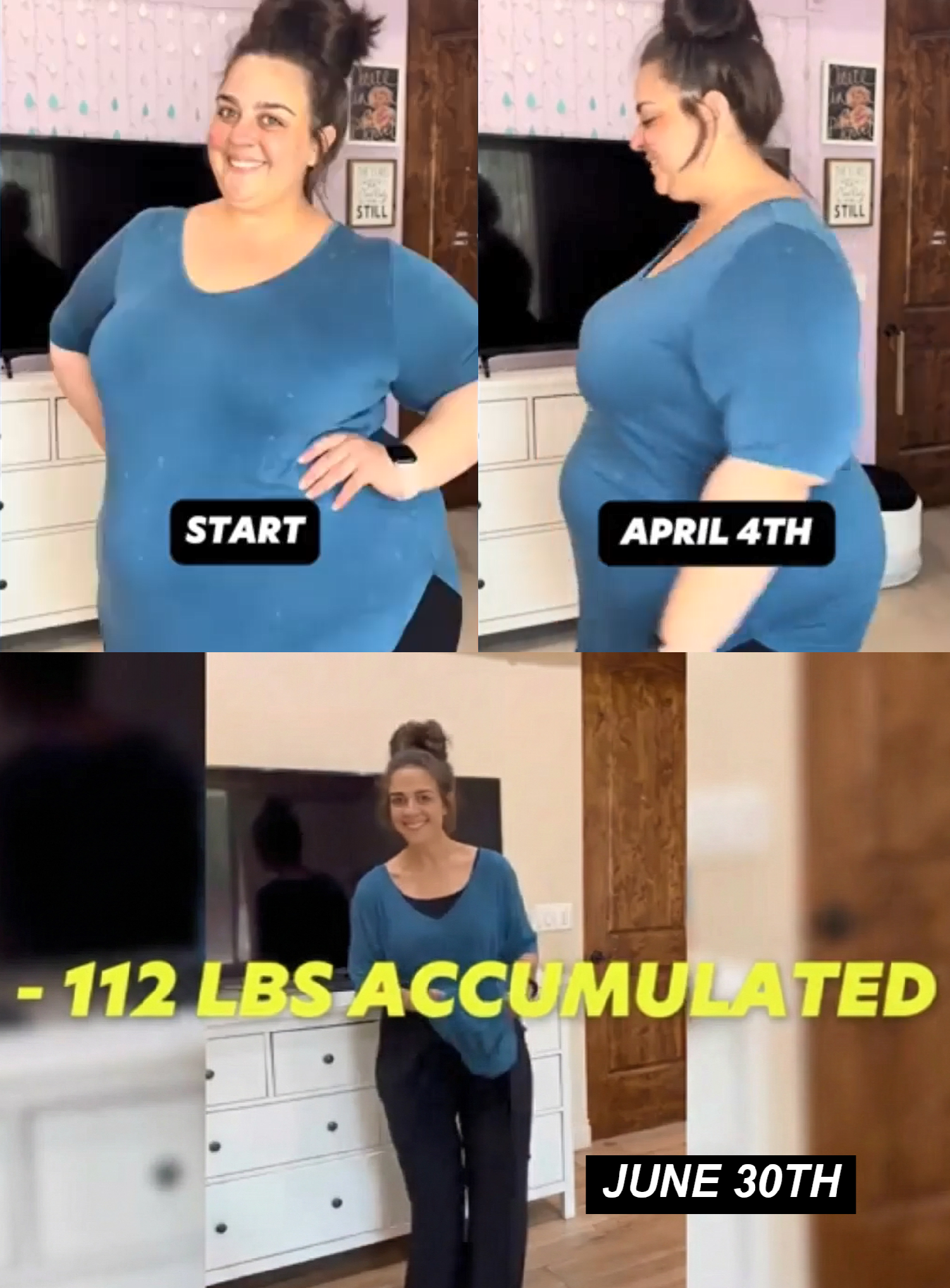 Before and after weight loss